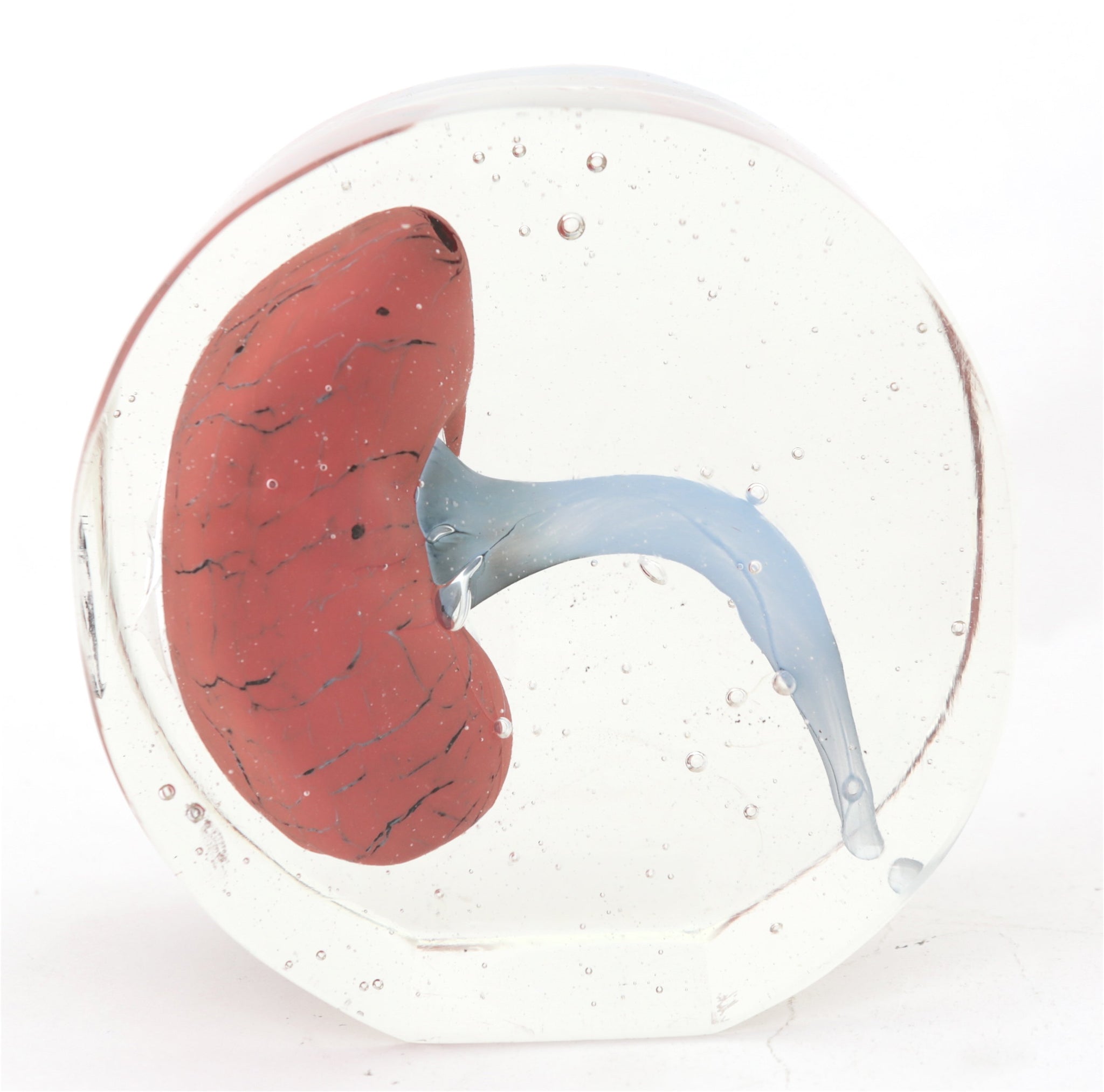 'Kidney' | 13x12.5x7cm